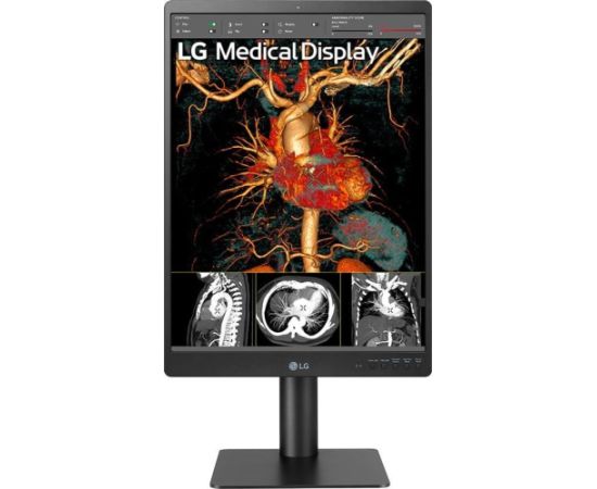 Monitors LG Medical display 21HQ513D-B, 21.3"