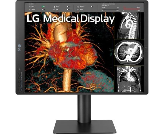 Monitors LG Medical display 21HQ513D-B, 21.3"