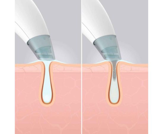 Homedics FAC-HY100 Refresh Hydra Facial