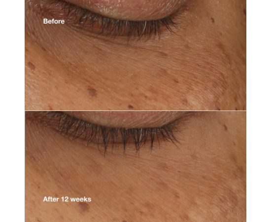 CLINIQUE_All About Eyes Brightening serum serum pod oczy 10ml