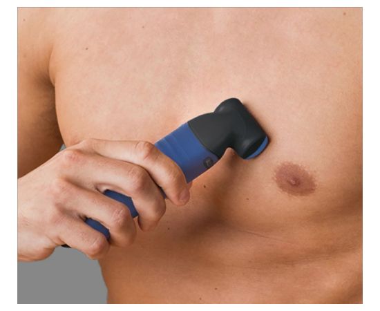 Remington Body Trimmer BHT6256 WETech Cordless Wet & Dry Number of length steps 5 Blue/Black